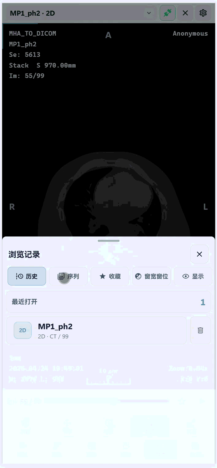 DicomVisionClient 界面截图